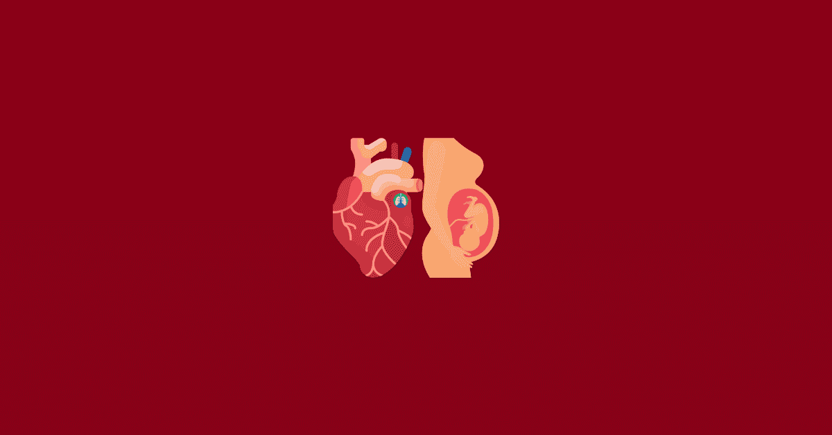 Congenital Cardiac Defects Overview and Practice Questions