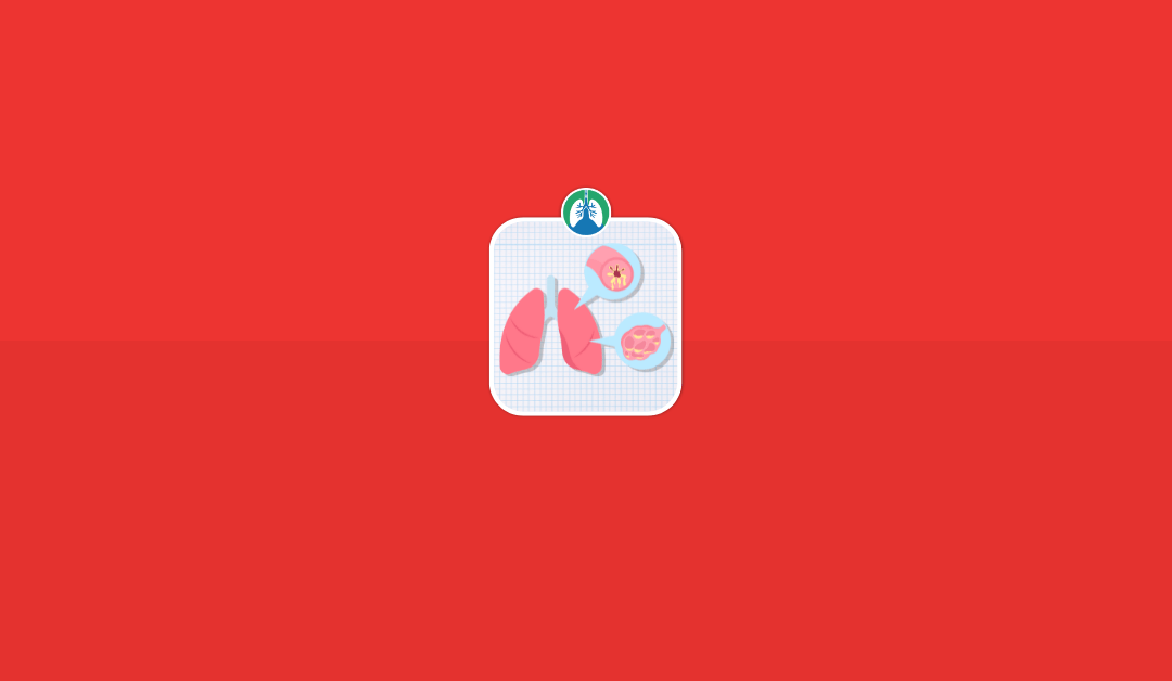 Chronic Bronchitis: Overview and Practice Questions (2023)
