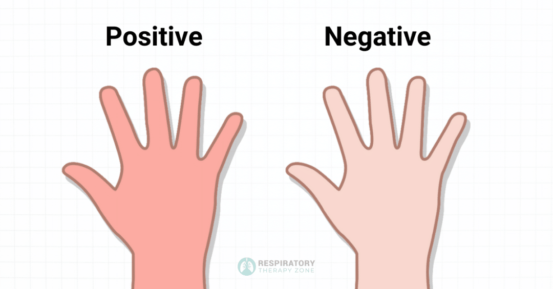 How to Perform a Modified Allen Test StepbyStep (2023)