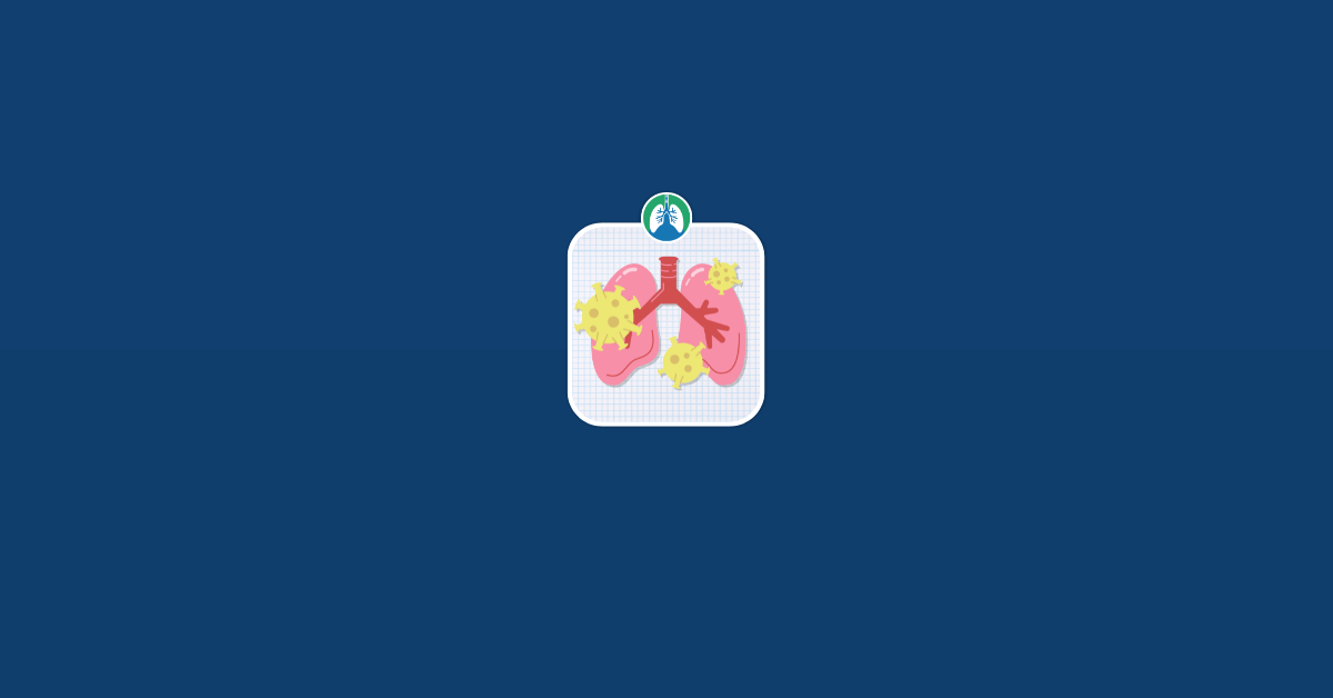 Chest Infection Home Remedies- How to Treat Symptoms at Home Vector