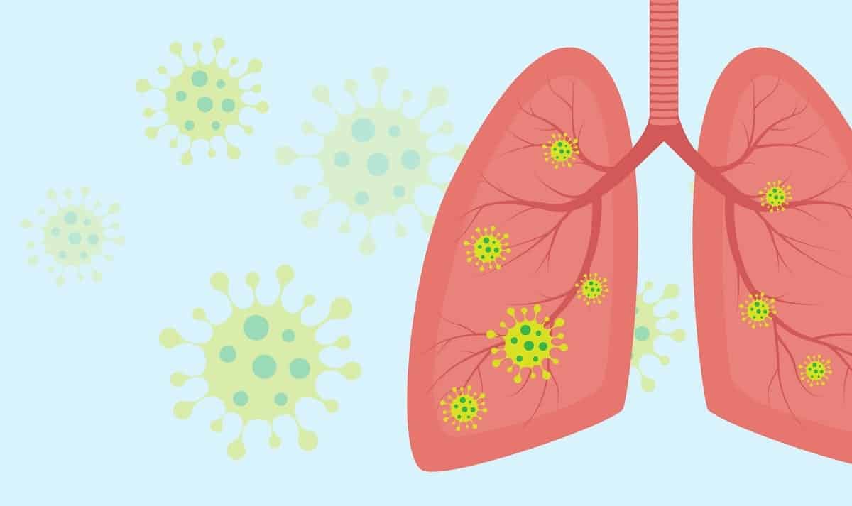 Lung infection virus vector illustration