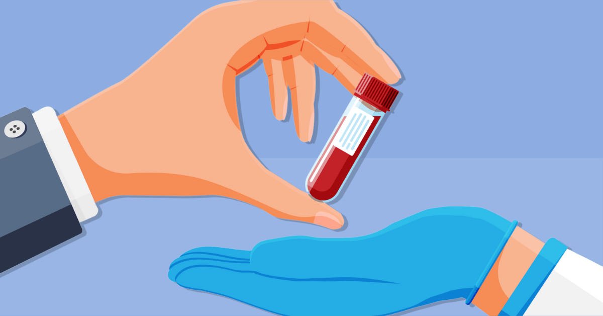 How to Pass a PEth Test Blood Sample