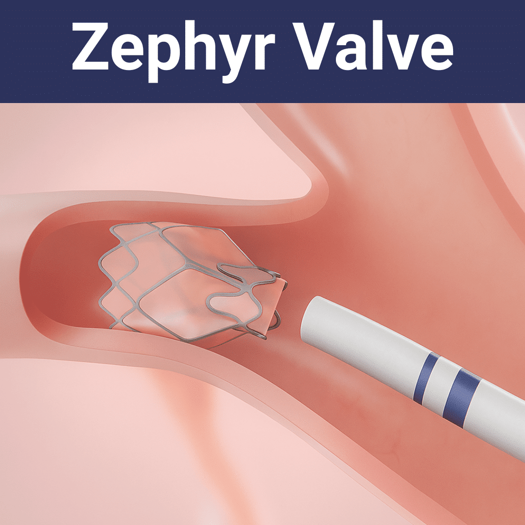 Zephyr Valve for COPD Illustration