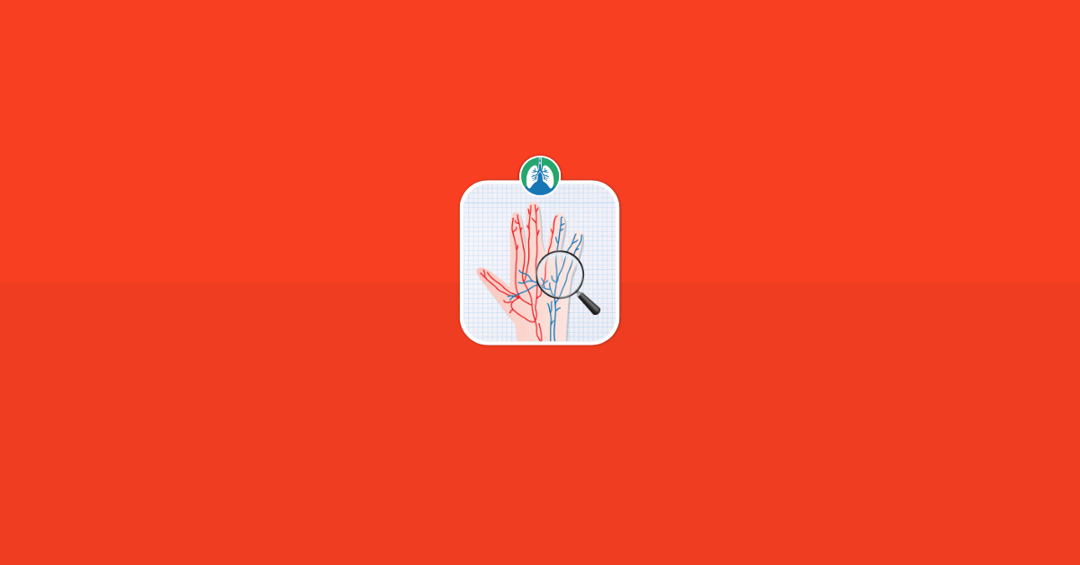 Best Vein Finder Transilluminator Devices Vector