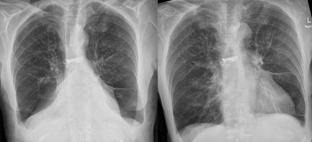 What Do Healthy Lungs Look Like? (2024)