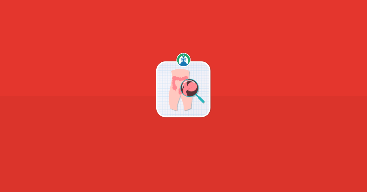 Hiatus Hernia Cough Vector