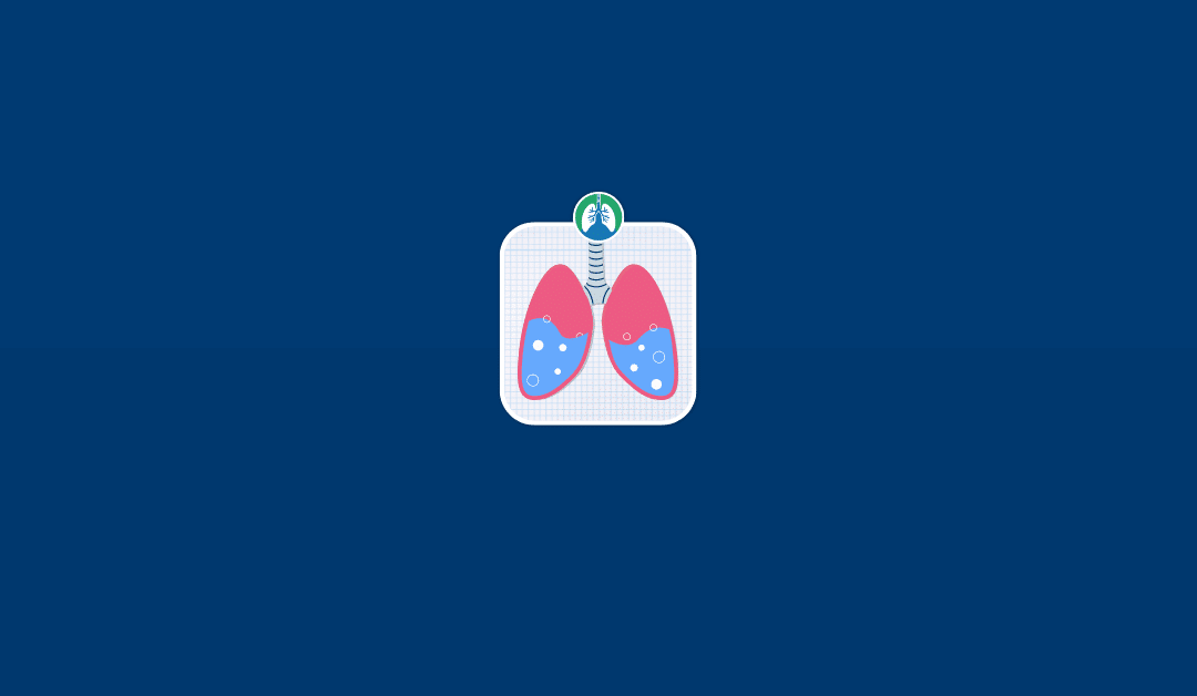 Pulmonary Edema vs. Pneumonia: An Overview (2025)