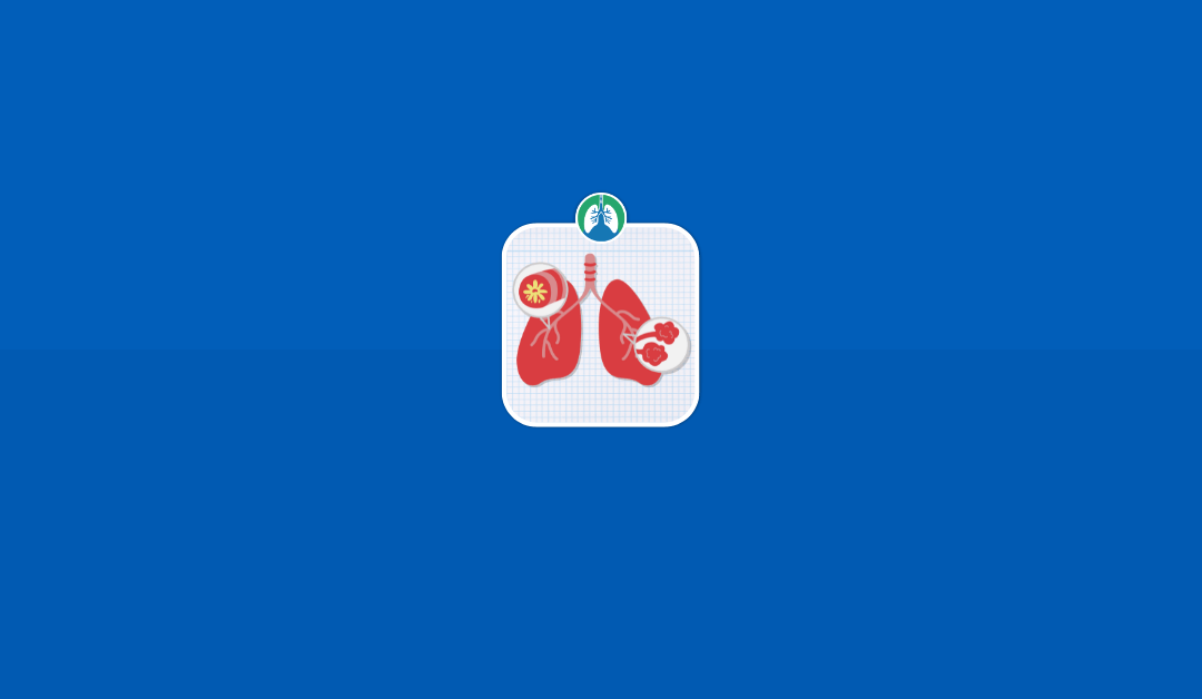 What is an Acute Exacerbation of COPD? (2025)
