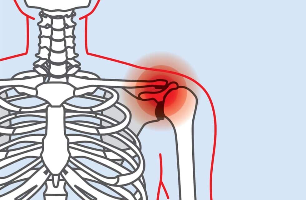 Gas Pain in Shoulder: Causes and Treatment Options (2023)