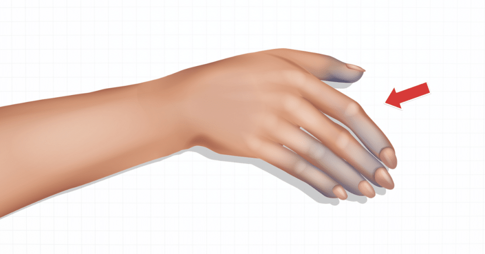 Cyanosis Causes, Symptoms, and Treatment (2024)