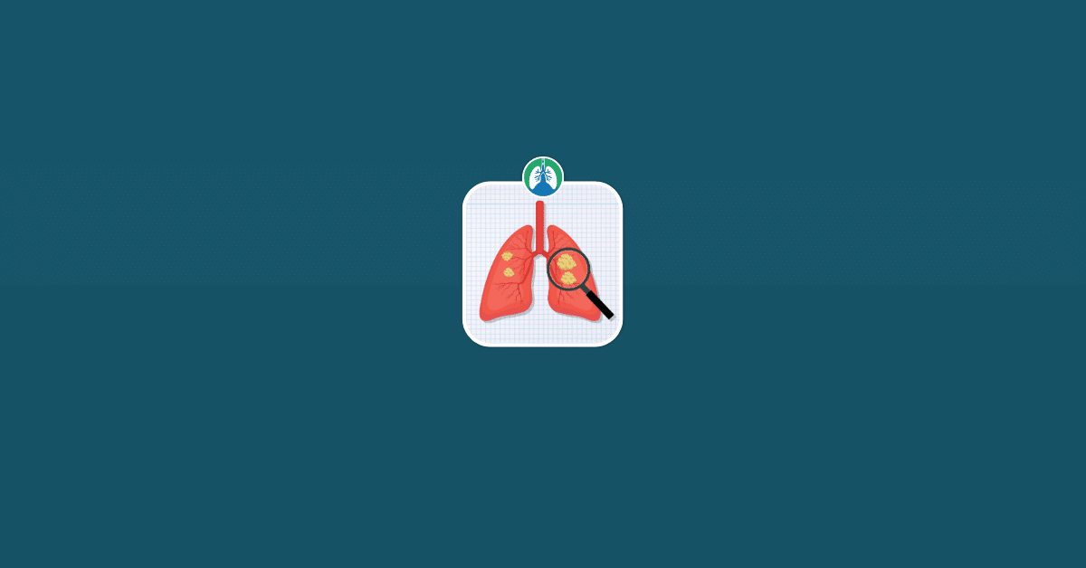List of Rare Lung Diseases Vector