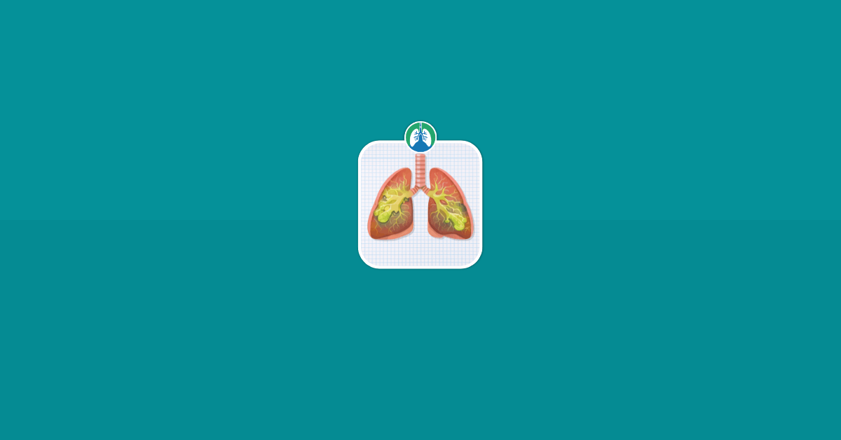 Phlegm Causes, Colors, Symptoms, and What It Means Vector Phlegm Causes, Colors, Symptoms, and What It Means Vector