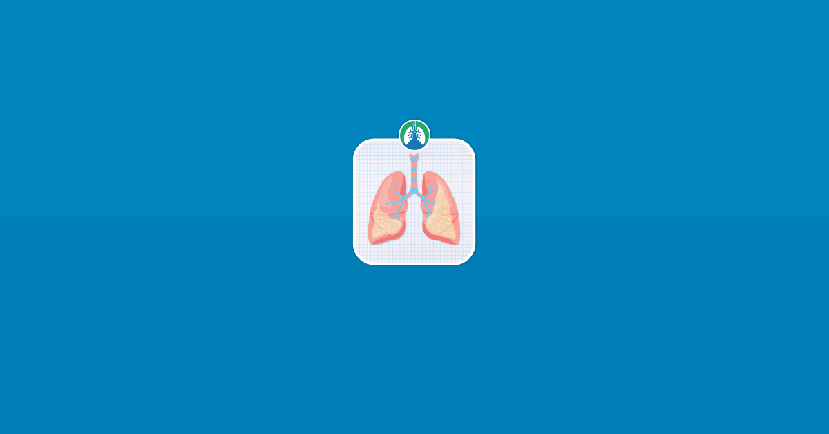 Pulmonary Edema Lungs Vector