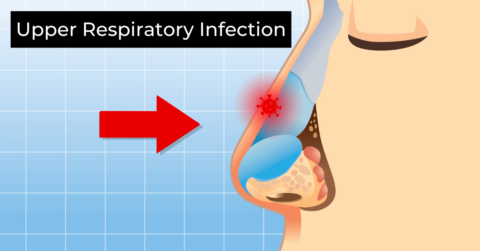 List of 15+ Types of Upper Respiratory Infections (2025)
