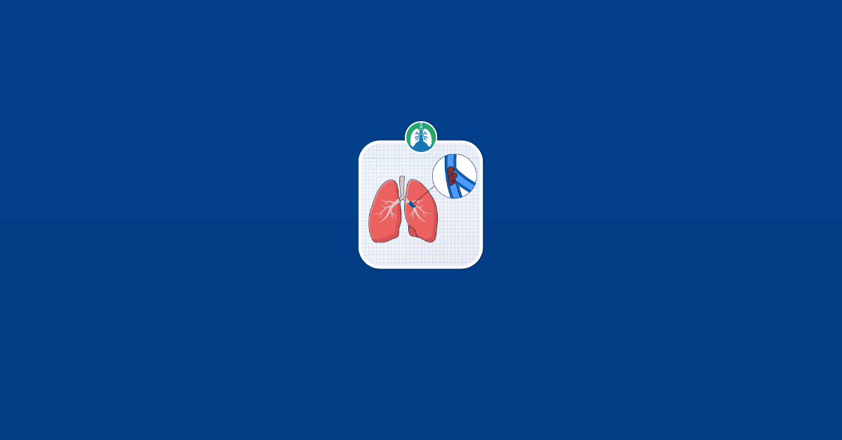 What Is the Recovery Time for Blood Clots in the Lungs Vector