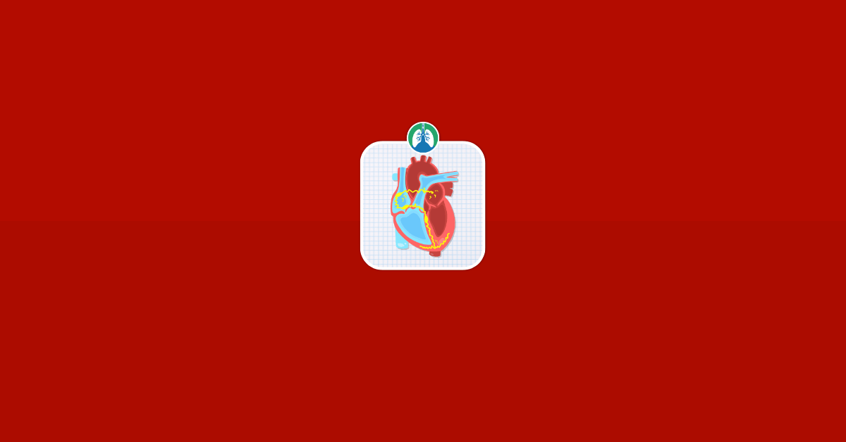 Cardiac Electrophysiology Illustration Vector Cardiac Electrophysiology Illustration Vector
