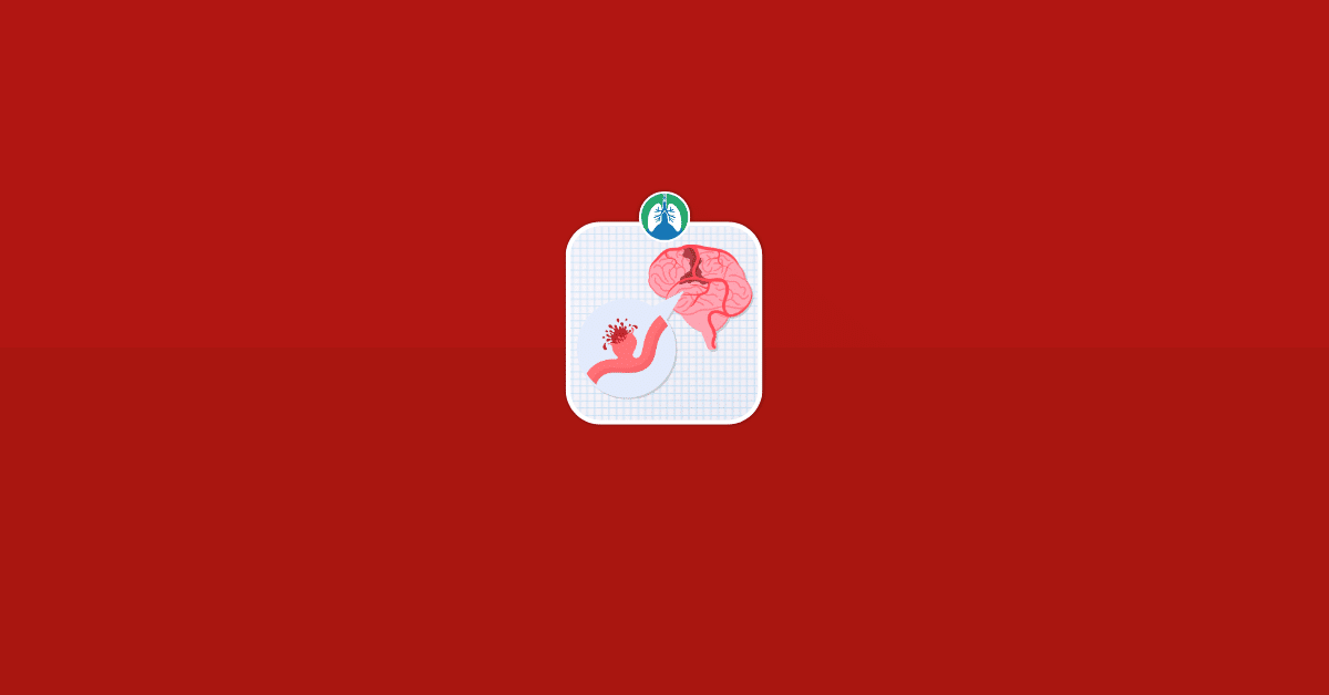 Early Warning Signs of a Stroke Vector Image Early Warning Signs of a Stroke Vector Image