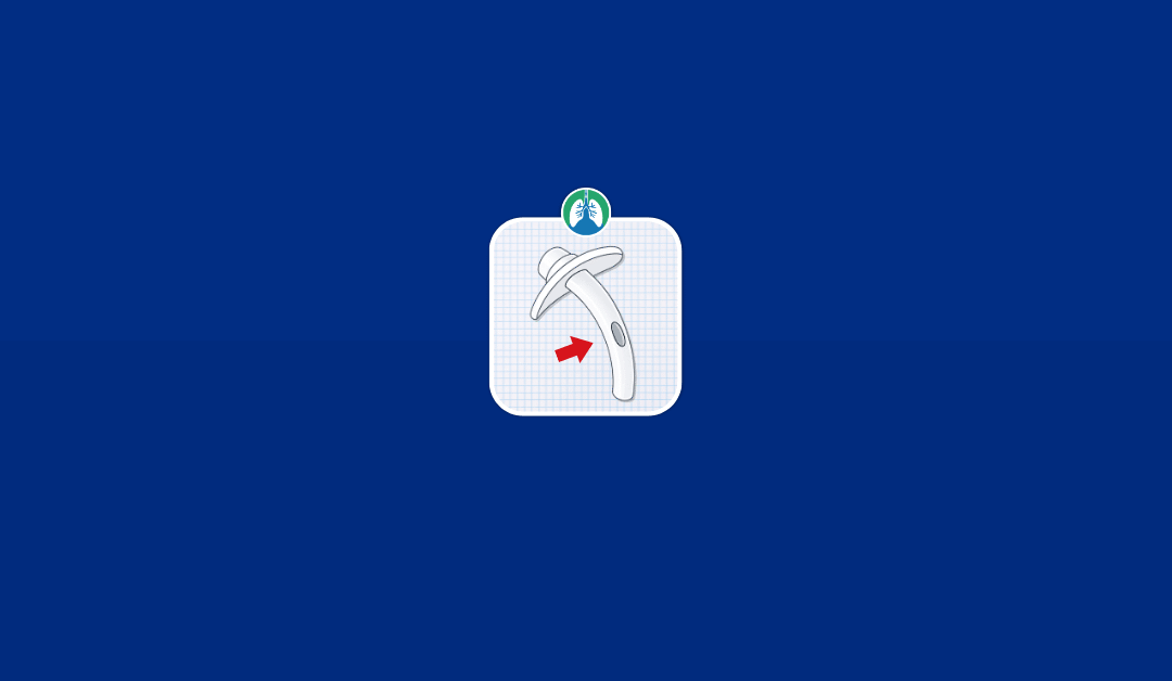 Fenestrated vs. Non-Fenestrated Tracheostomy Tube (2026)