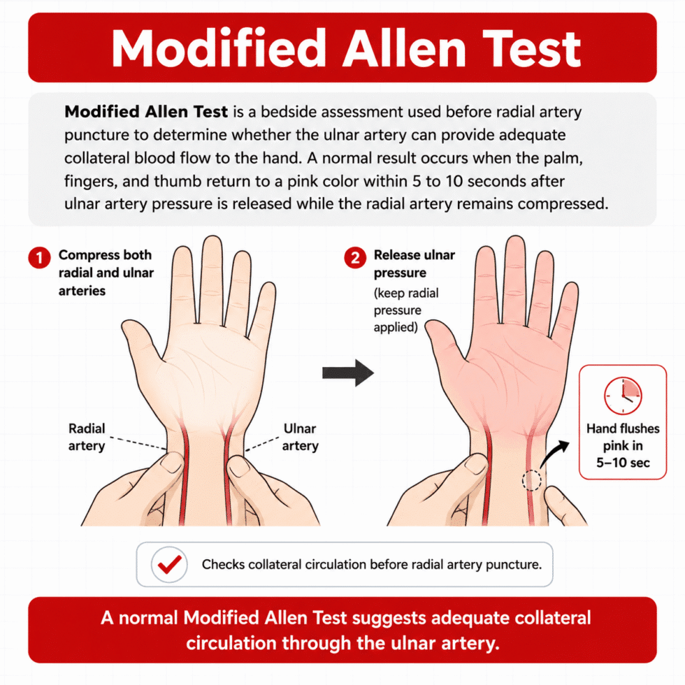 Modified Allen Test for Radial Artery Blood Sampling