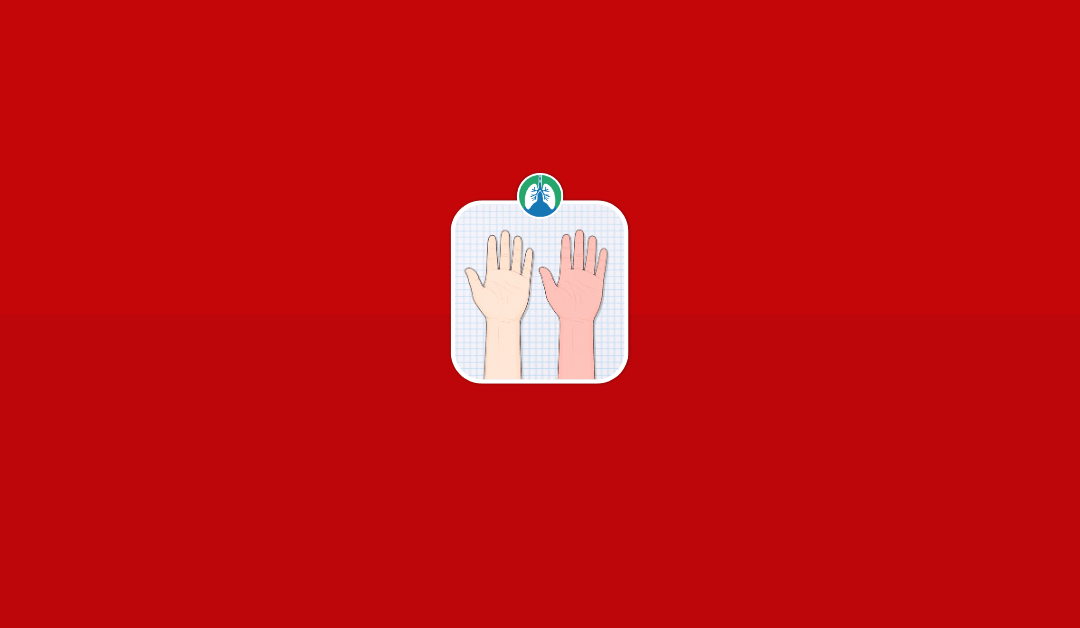 Modified Allen Test for Radial Artery Blood Sampling