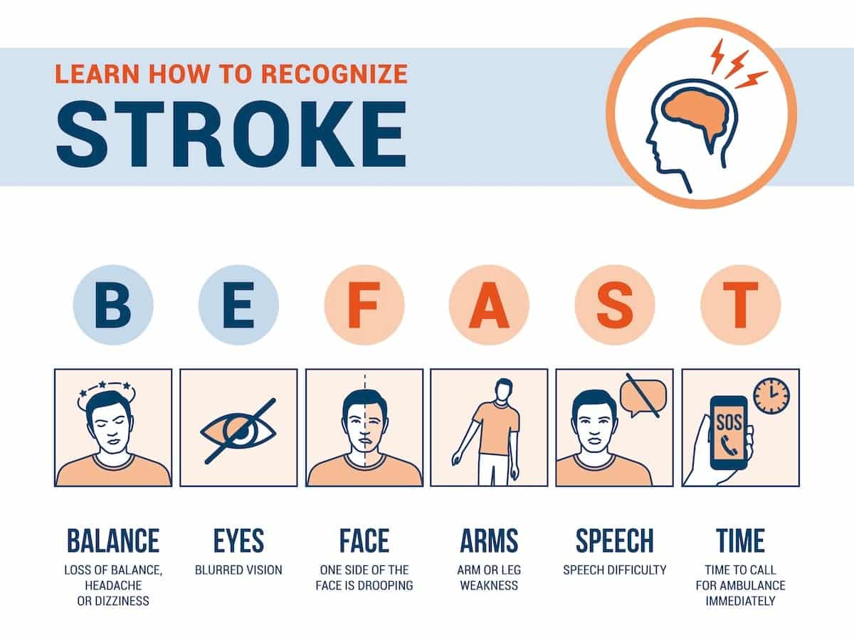 Top 10 Early Warning Signs Of A Stroke You Must Know 2025 