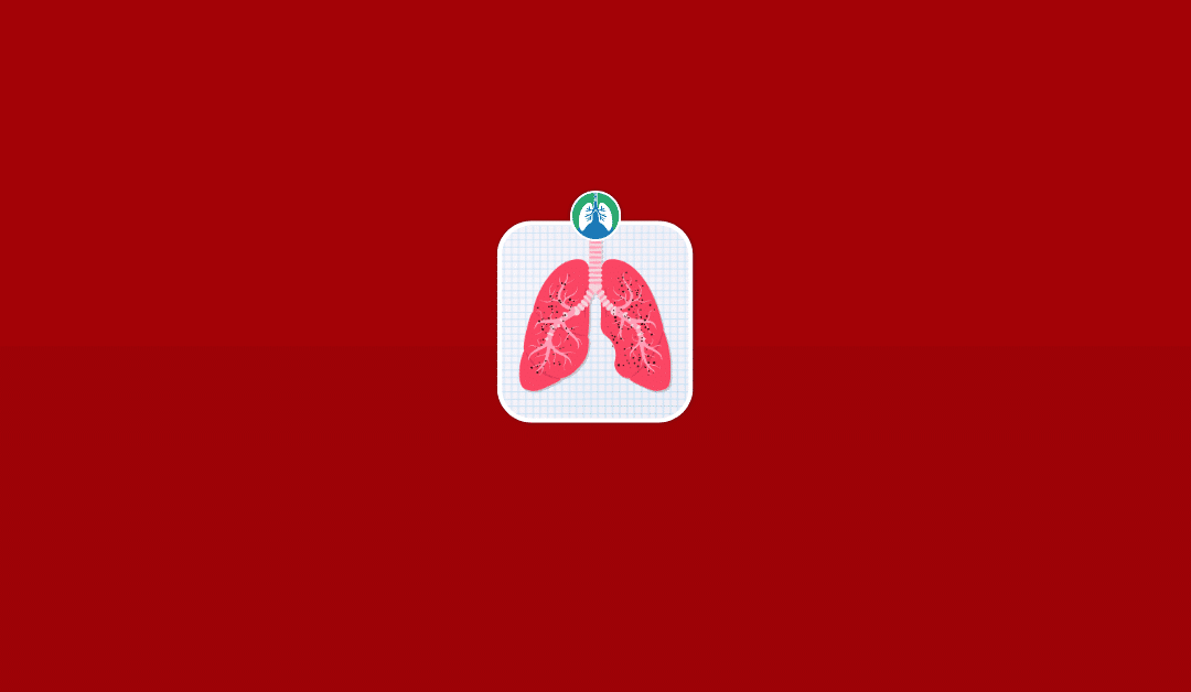 Silicosis: Causes, Symptoms, Diagnosis, and Treatment