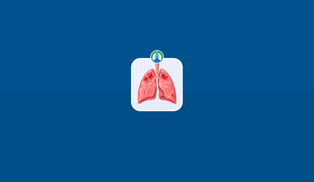 Tuberculosis (TB): Causes, Symptoms, Diagnosis, and Treatment