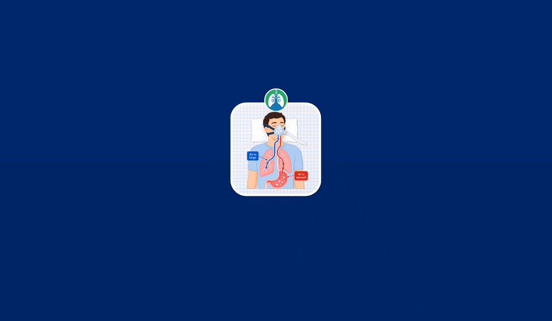 Can CPAP Cause Gas? Why It Happens and How to Reduce It