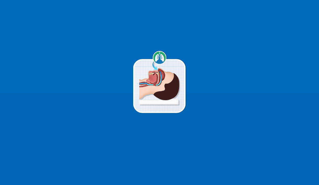 Sleep Apnea: Overview and Practice Questions (2025)