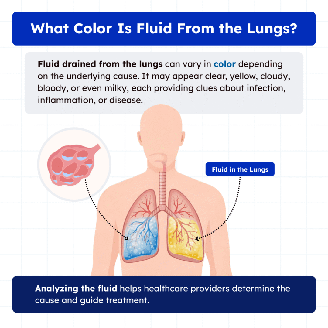 What Color is Fluid Drained From the Lungs? (2026)