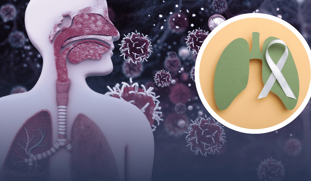 November is Lung Cancer Awareness Month: Learn and Support