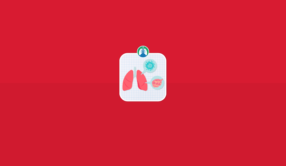 Pneumonia: Pathophysiology and Clinical Management Guide