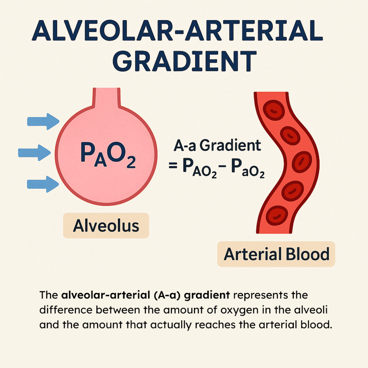Alveolar Arterial Gradient A a Overview And Calculation