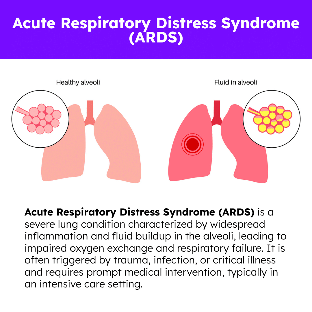 Acute Respiratory Distress Syndrome (ARDS) Illustration infographic