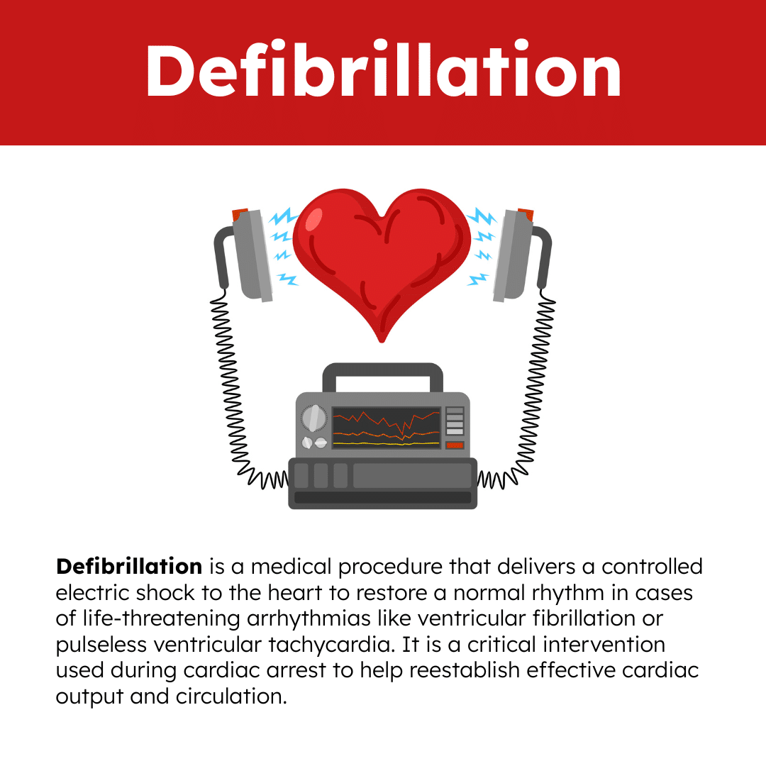 Defibrillation Illustration infographic
