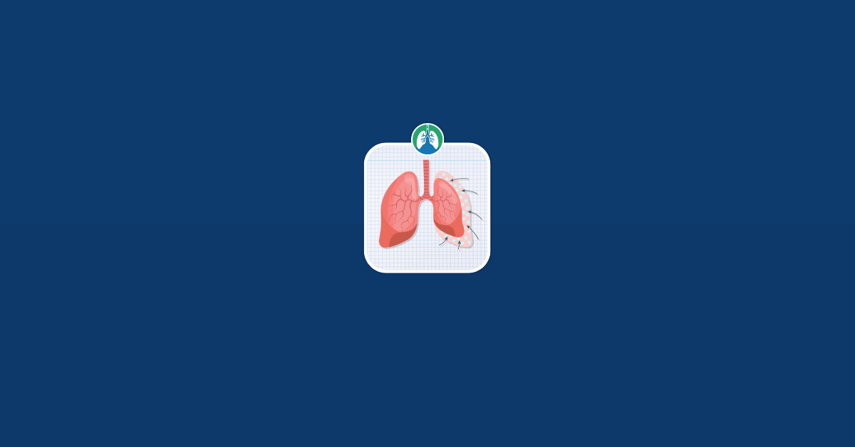 How Long Can You Live With a Collapsed Lung Vector
