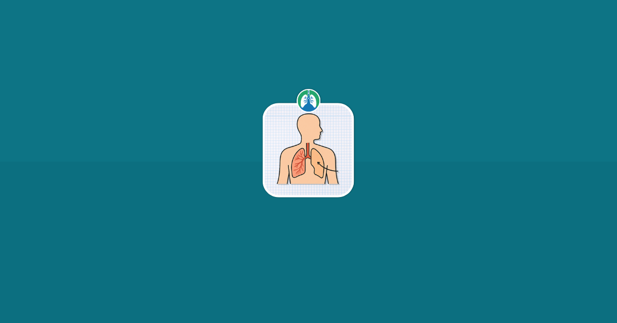 Pulmonary Agenesis Causes, Diagnosis, and Treatment Vector