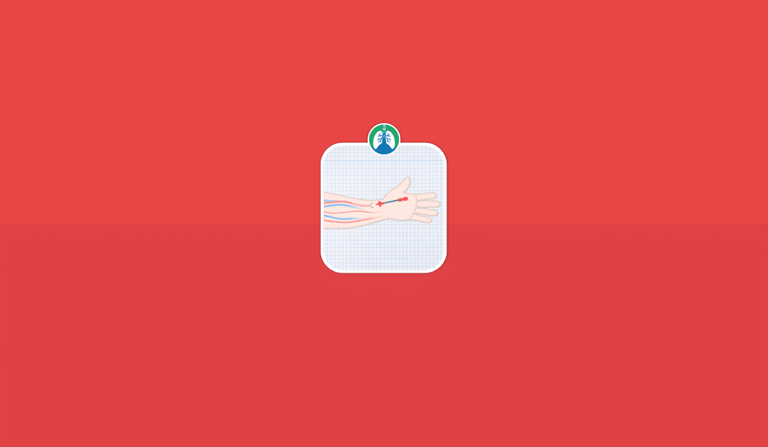 Arterial Line: Overview and Practice Questions (2025)