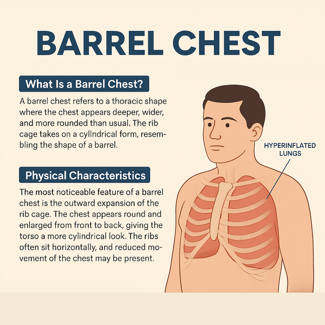 Barrel Chest What Is It And What Does It Mean For COPD 