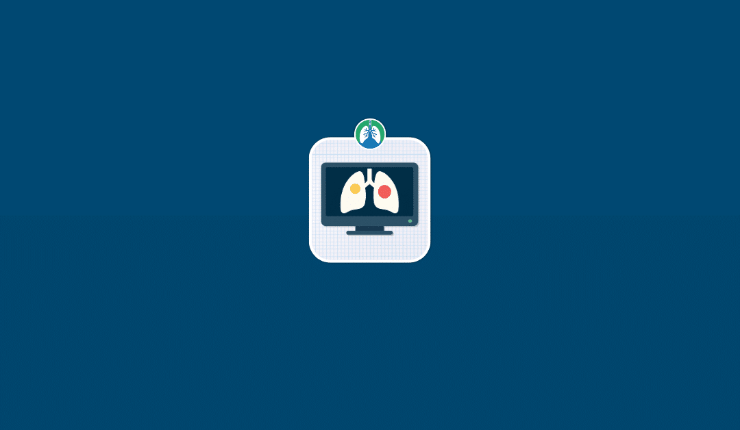 How Accurate is a CT Scan for Lung Cancer? (2025)
