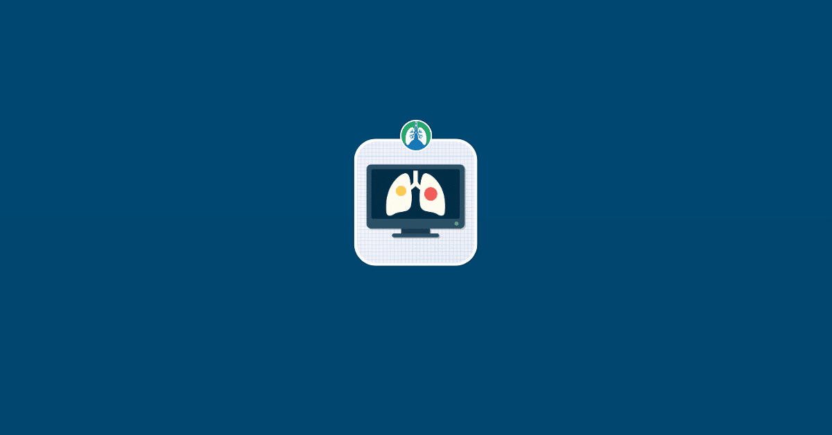 How Accurate is a CT Scan for Lung Cancer Vector