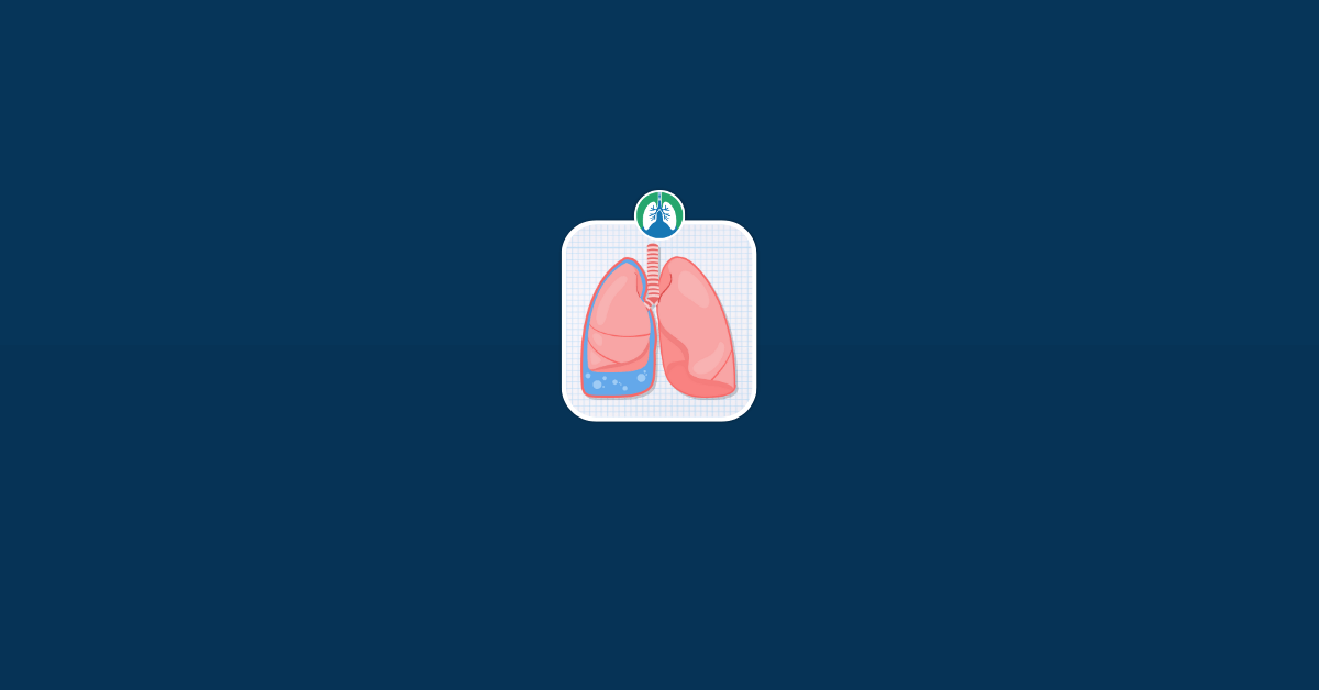 How to Get Fluid Out of the Lungs Vector