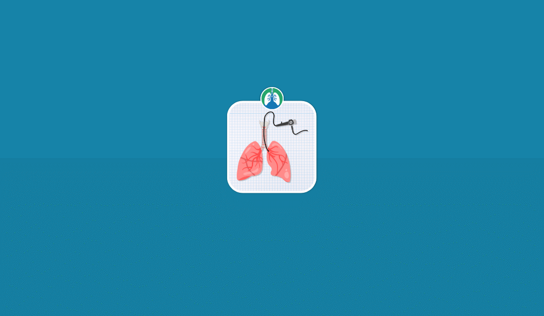 Bronchoalveolar Lavage: Overview and Practice Questions