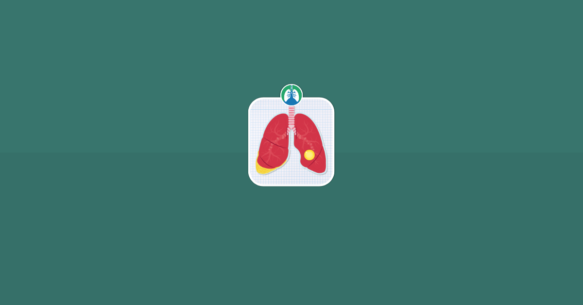 Difference Between Empyema and Lung Abscess Vector