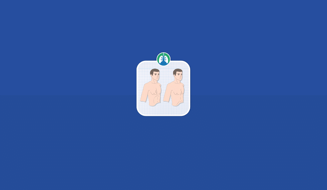 Pectus Excavatum vs. Pectus Carinatum: An Overview (2025)