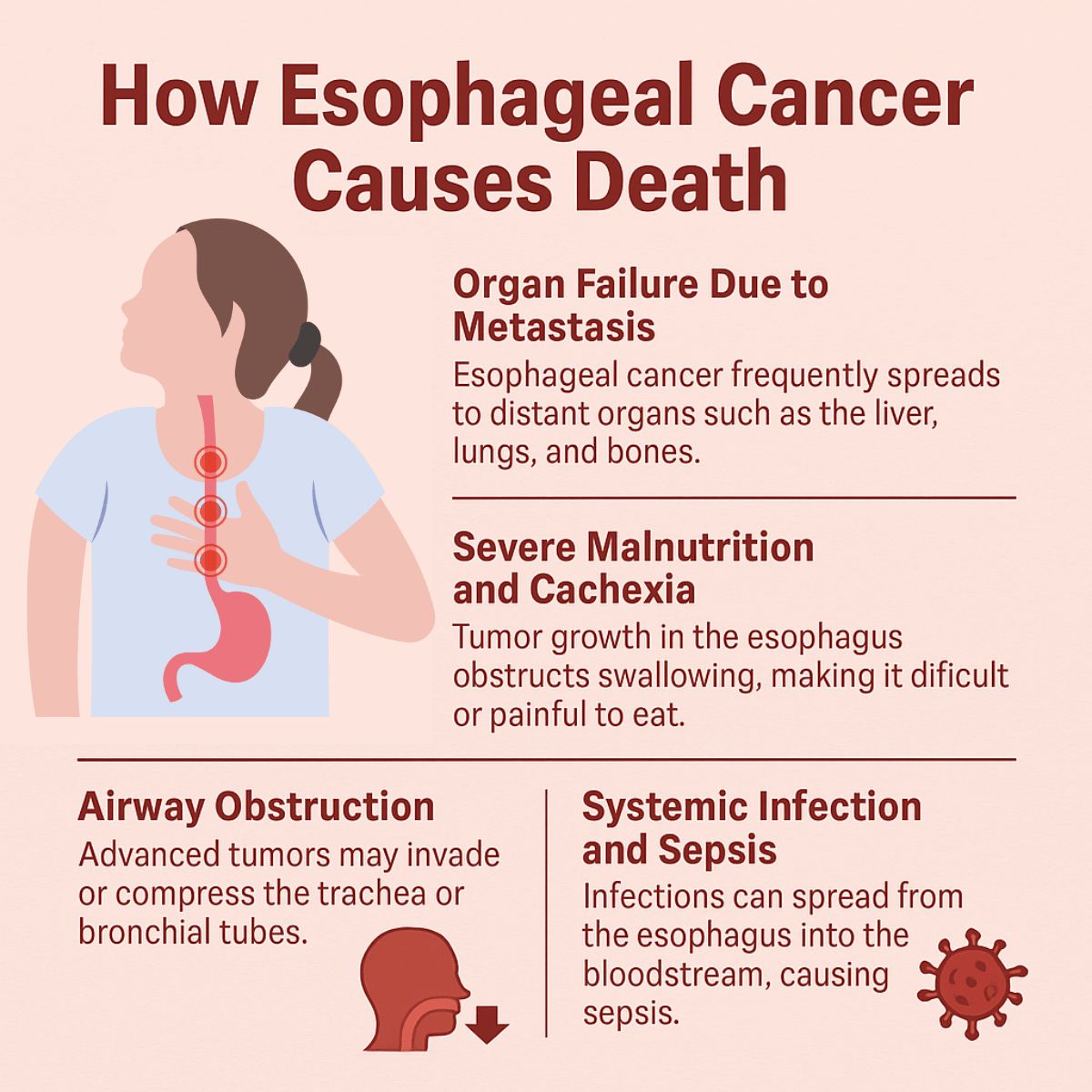 How Does Esophageal Cancer Kill You Illustration Infographic-min