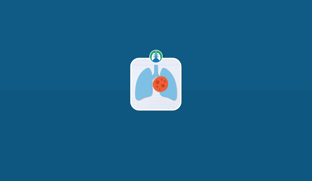 How Fast Do Mediastinal Tumors Grow? (2025)