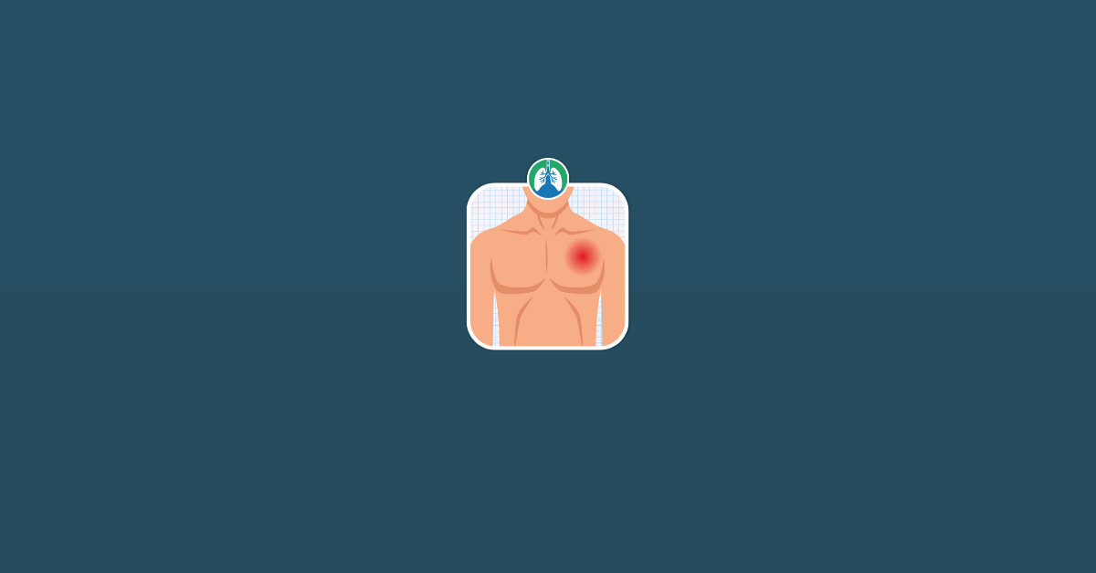 Symptoms of a Minor Chest Injury Vector