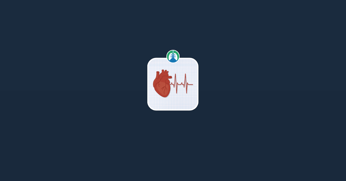 Tachycardia Illustration Vector