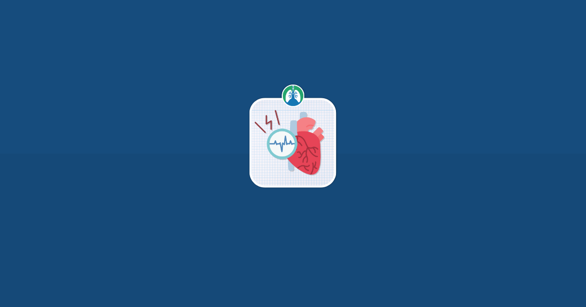 Cardioversion Illustration Vector